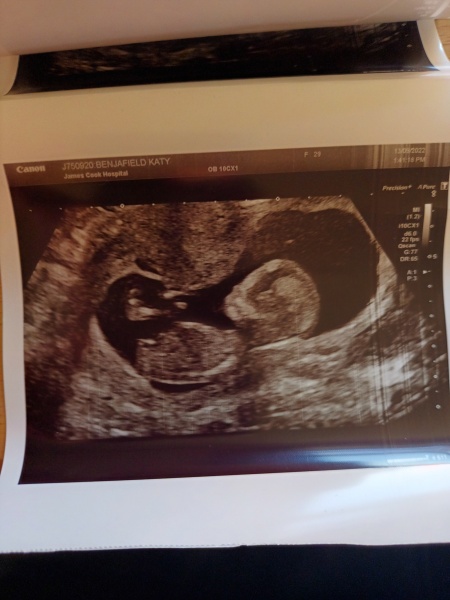 Nub theory? 13 weeks