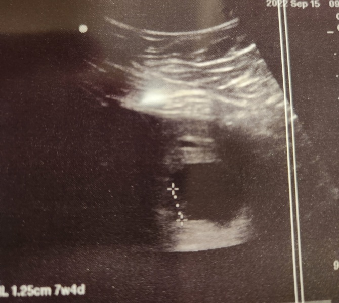 Babies Due April 2023 thread 5