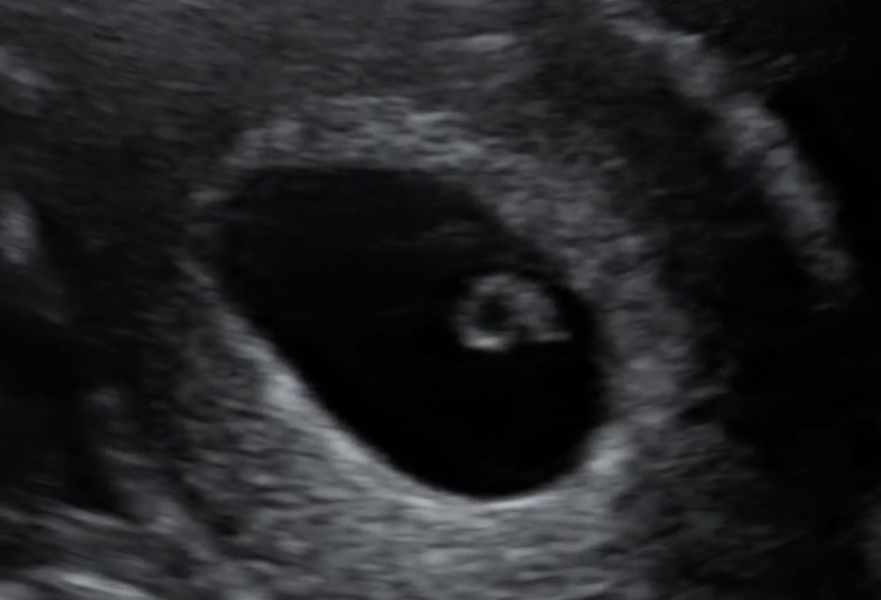 Babies Due April 2023 Thread 4 