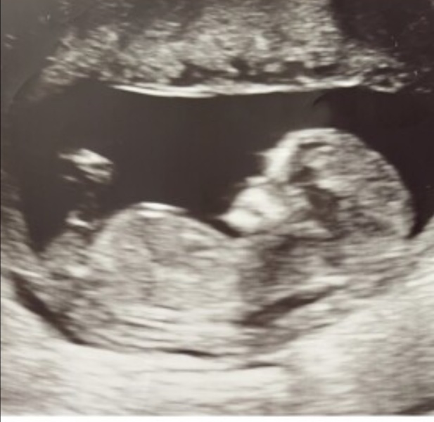 Boy or girl nub please?