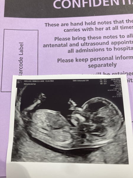 Due March 2023 - thread 3