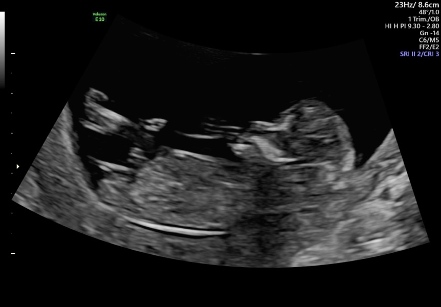 Due March 2023 - thread 3