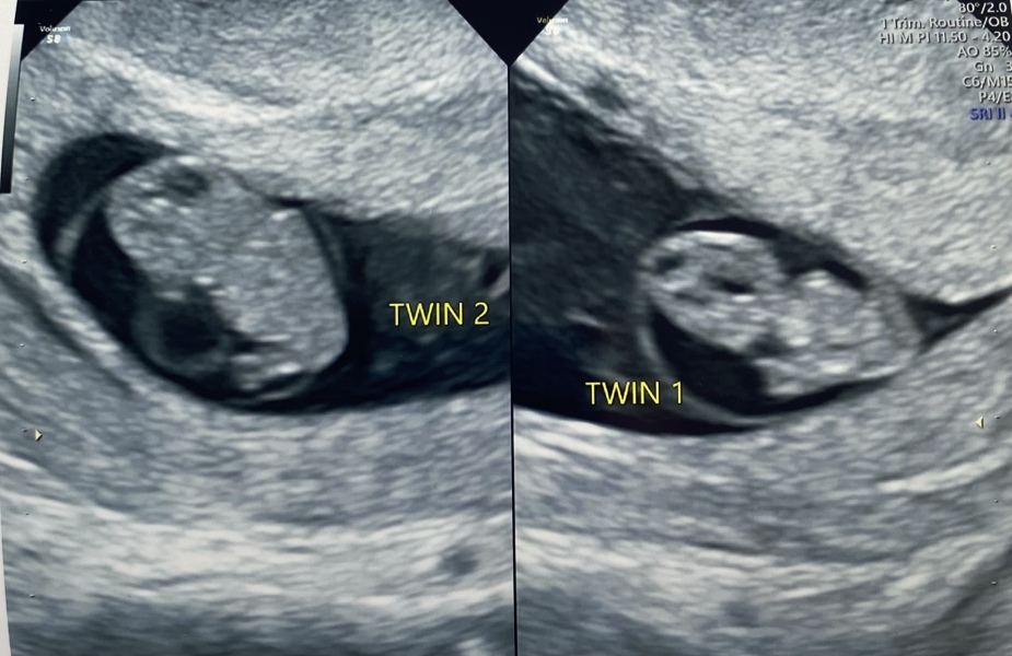 Babies Due April 2023 Thread 4 