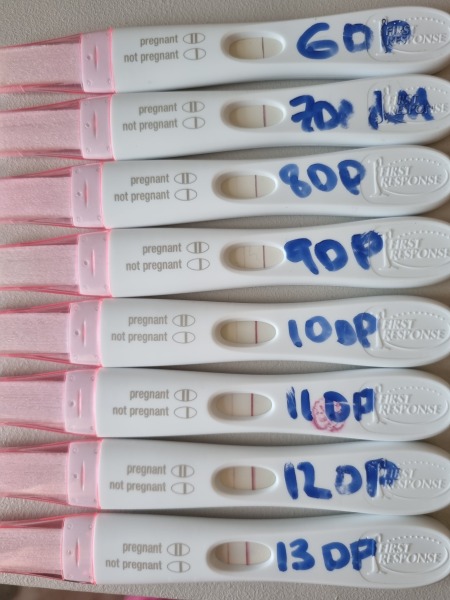 PCOS and hCG Levels