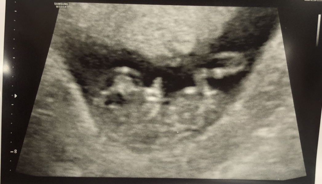 Babies Due April 2023 thread 5