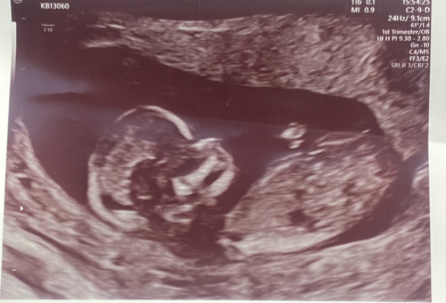 Girl or Boy?