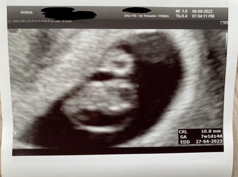 Babies Due April 2023 Thread 4 