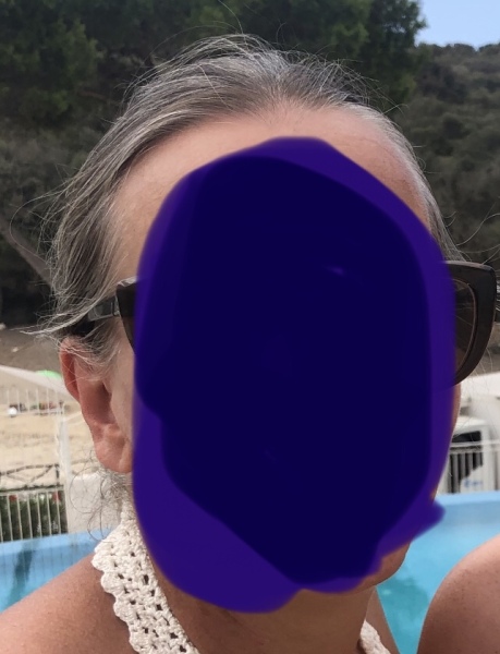 Dark hair going grey. 