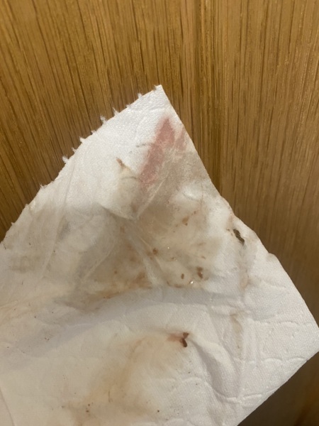 possible implantation bleeding? (WARNING, GRAPHIC IMAGES)