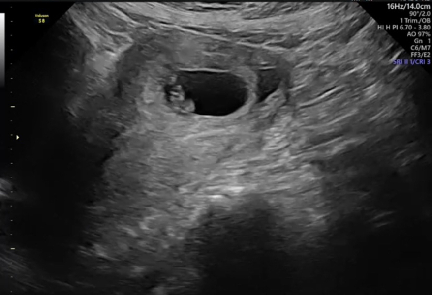 Babies Due April 2023 Thread 4 