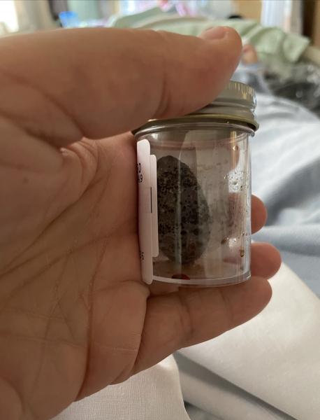 Tummy troubles and gallstones