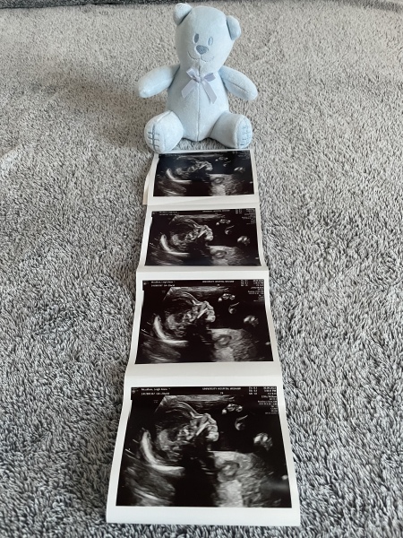 Due Feb/Mar after MC 🌈 🙈 Thread 2