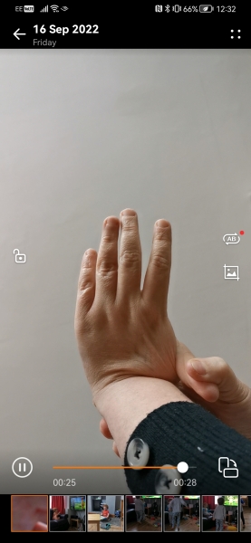 Can you do this to your arm? *PICTURE ATTACHED *