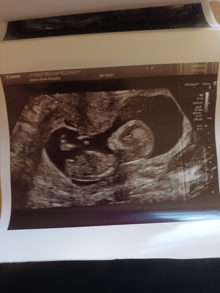 12 week scan. Gender guesses?