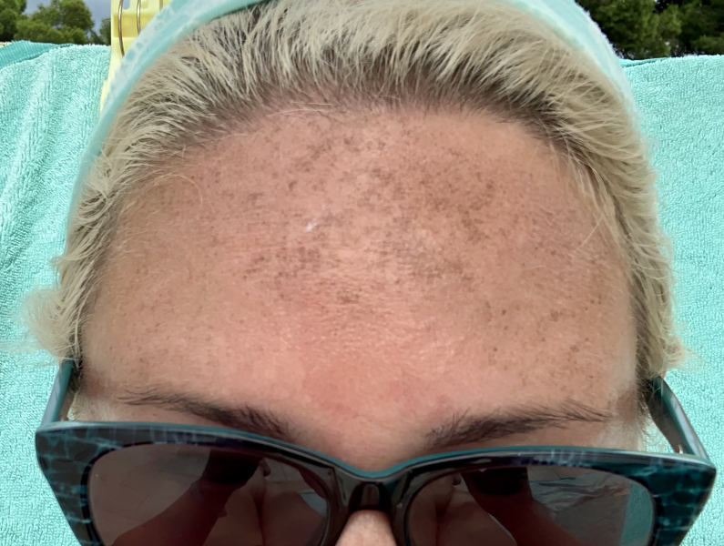 Any dermatologists?