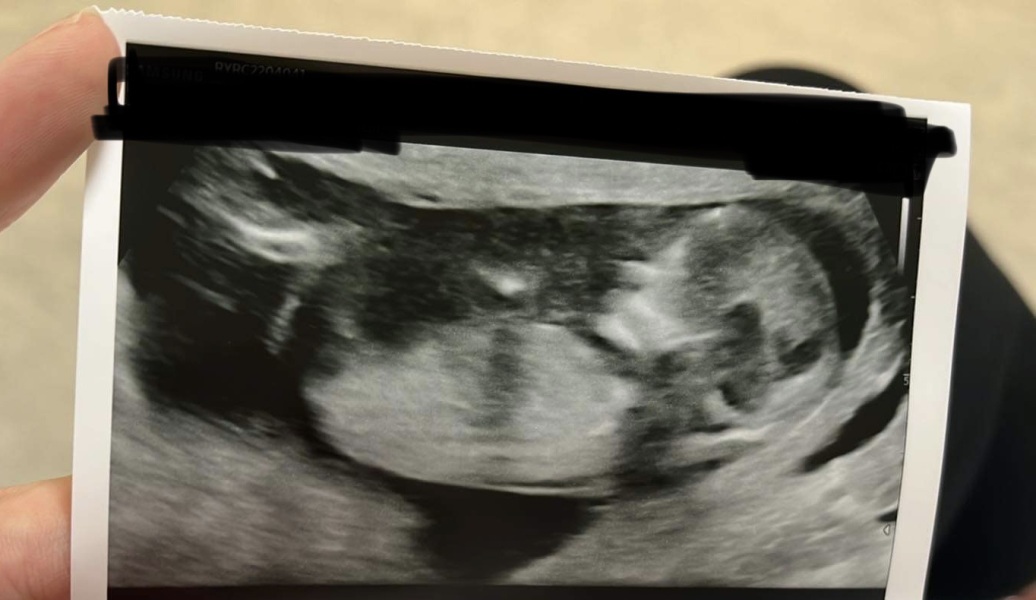 Girl or boy?