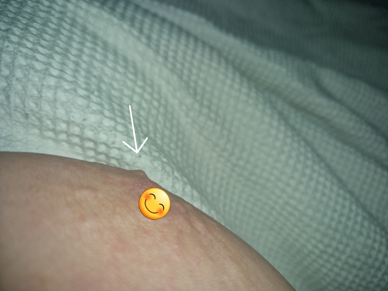 Nipple thingy?