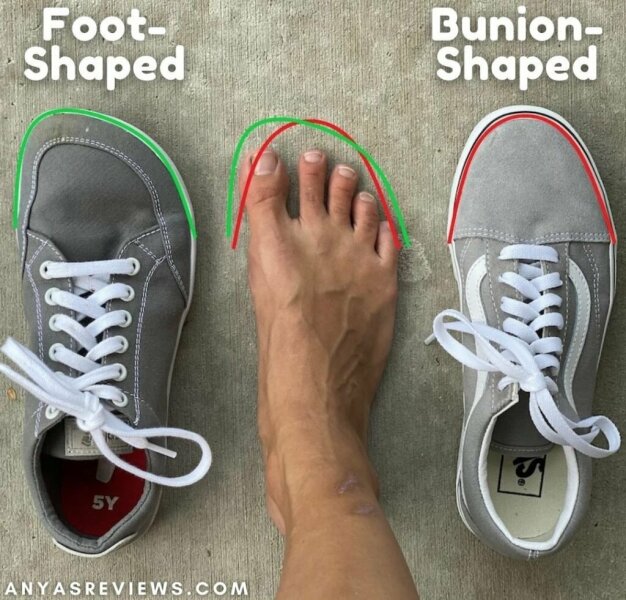 What the FUCK is wrong with my foot?  *picture attached*