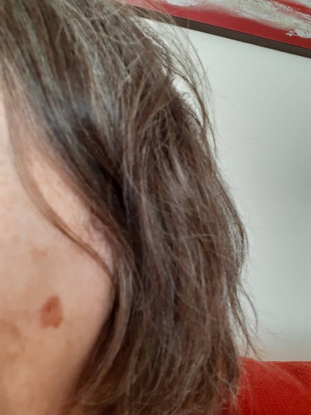 What's this on my face? Pic attached