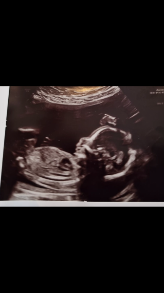 Caroline Lucas: “Local democracy felt revolutionised and re-energised” - why we need to permanently reinstate hybrid council meetings.