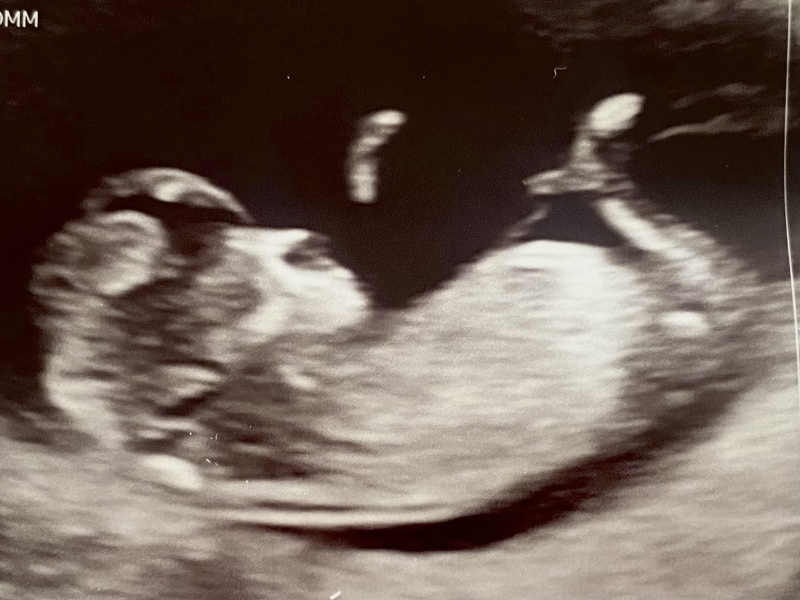 Gender Predictions? Just for fun! 