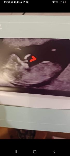 Due March 2023 - thread 3