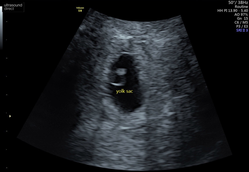 Babies Due April 2023 Thread 4 