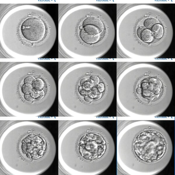 IVF - Stims Aug - Egg Collection Sep