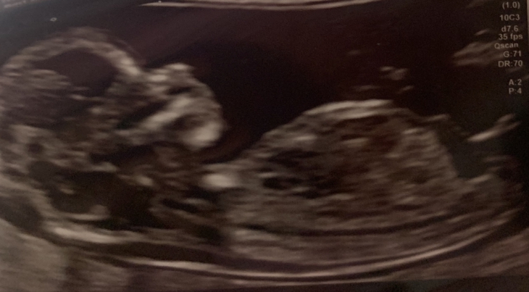 Due March 2023 - thread 3