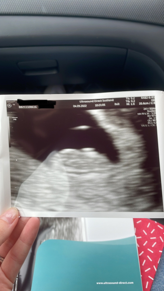 Babies Due April 2023 Thread 4 