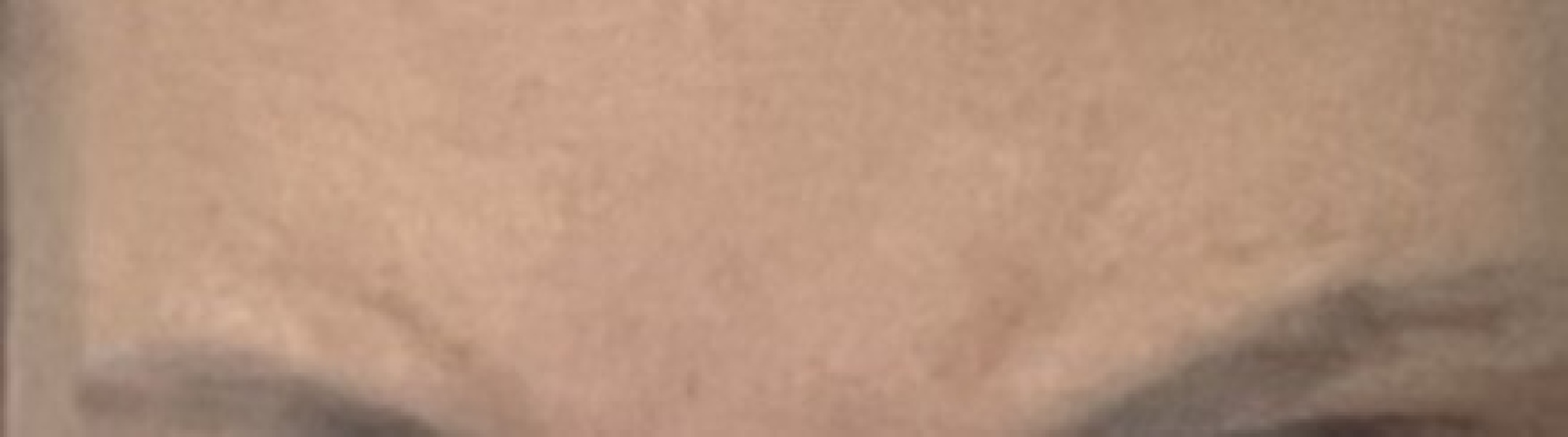 'Dents' above eyebrows anything I can do snot them?