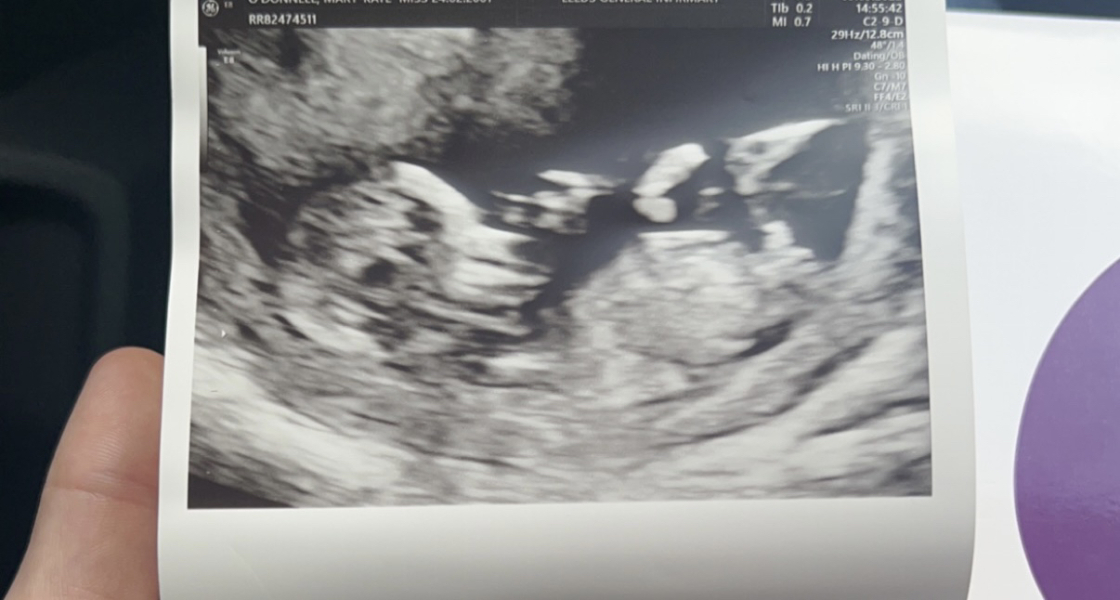 Due March 2023 - thread 3