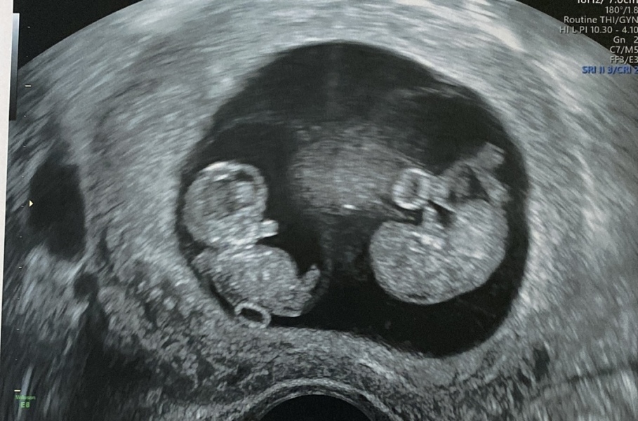 Babies Due April 2023 thread 5