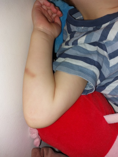 To be worried preschool staff are hurting my son?