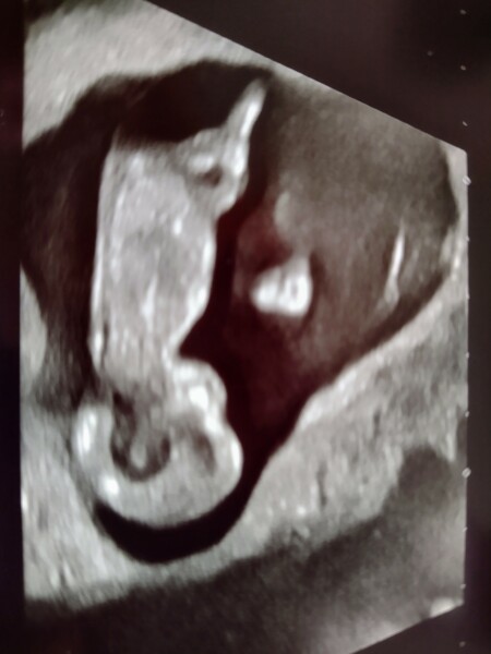 13 week gender guesses