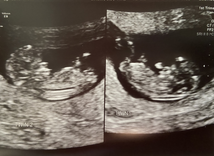 IVFers Due Mar & Apr 2023