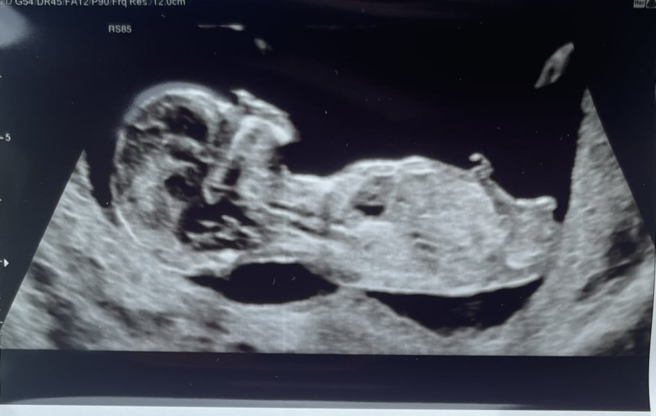 Due March 2023 - thread 3