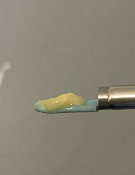 Is My Earwax Normal? (Pic)