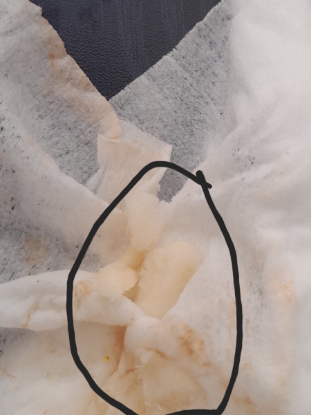White bits in toddlers sick.