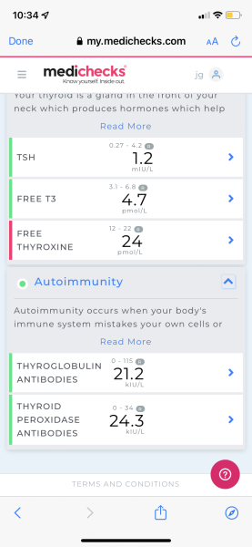 How long did it take to be diagnosed with Hashimotos disease?