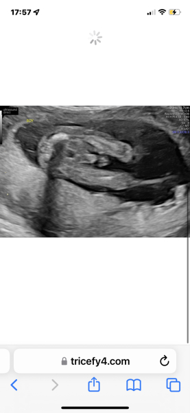 Due March 2023 - thread 3