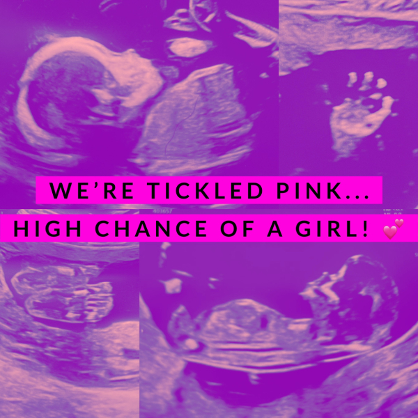 Baby January 2023!