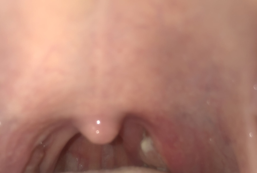 What is this?