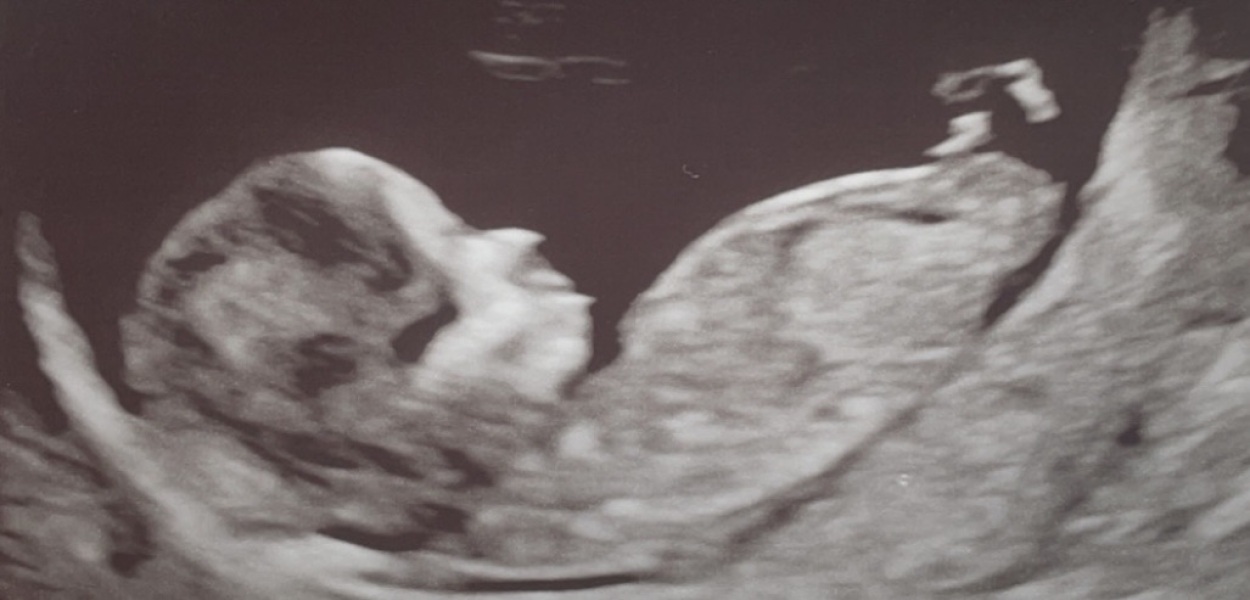 Cravings, nub / skull theory, gender prediction