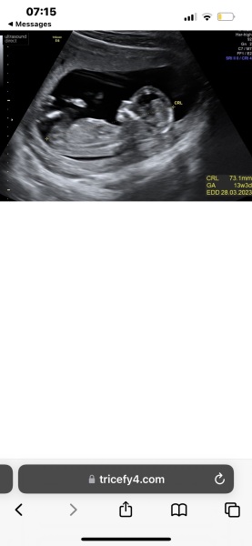 Gender Scan