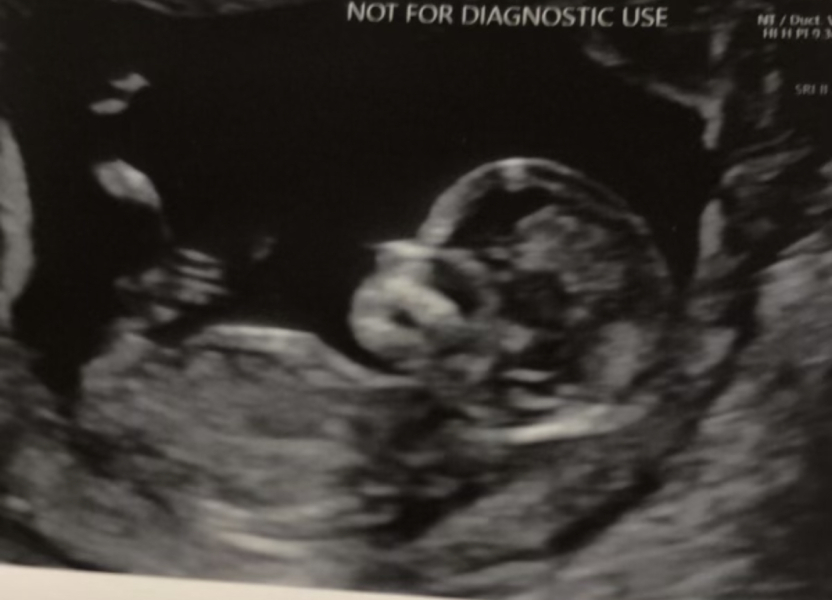 Girl or Boy? Gender predictions!