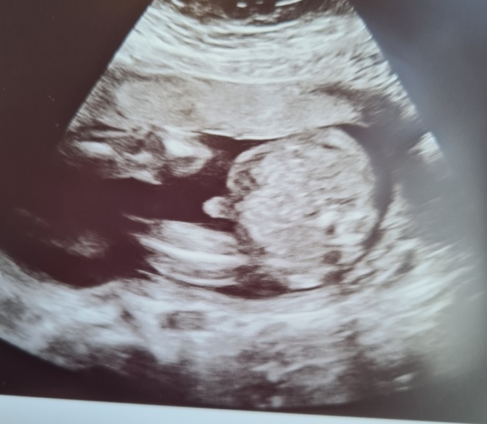 Girl or boy?