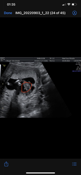 Girl or boy?