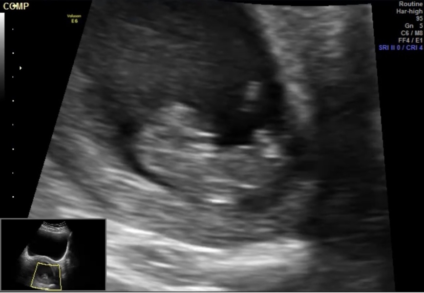 Babies Due April 2023 thread 5