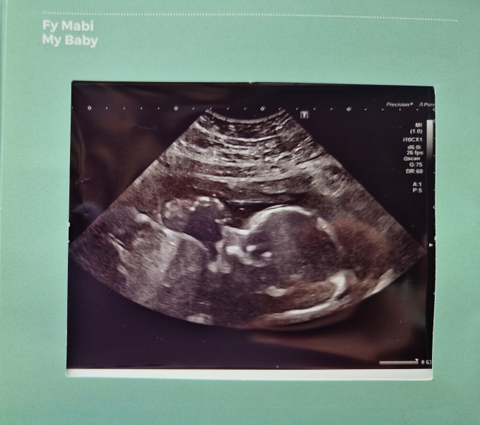 Baby girl names!